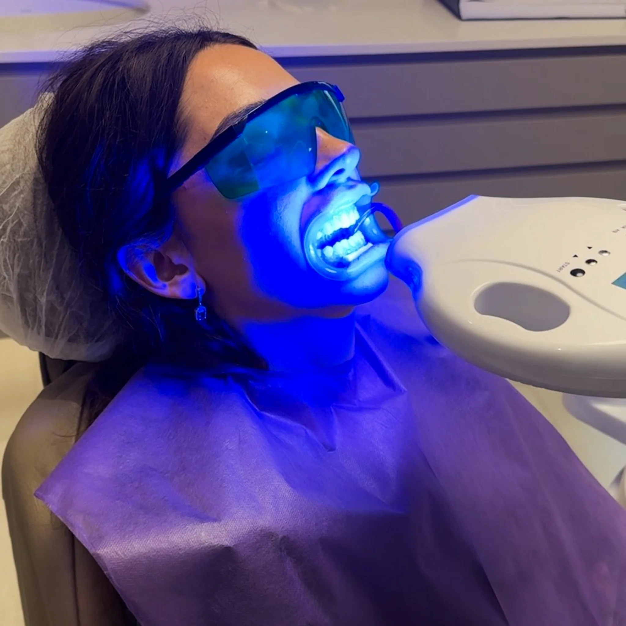 Diş Beyazlatma Sonrası Bakım ve Beslenme