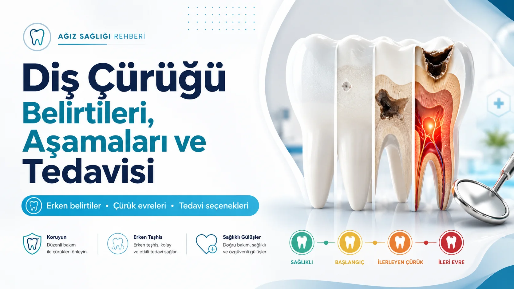 Diş Çürüğü Nasıl Başlar, Hangi Evrelerden Geçer?