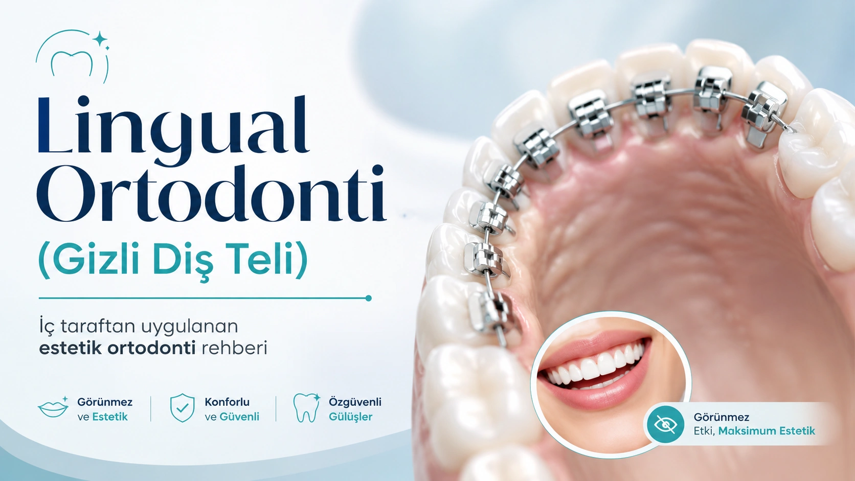 Lingual Ortodonti (Gizli Diş Teli): Nedir, Kimlere Uygun?