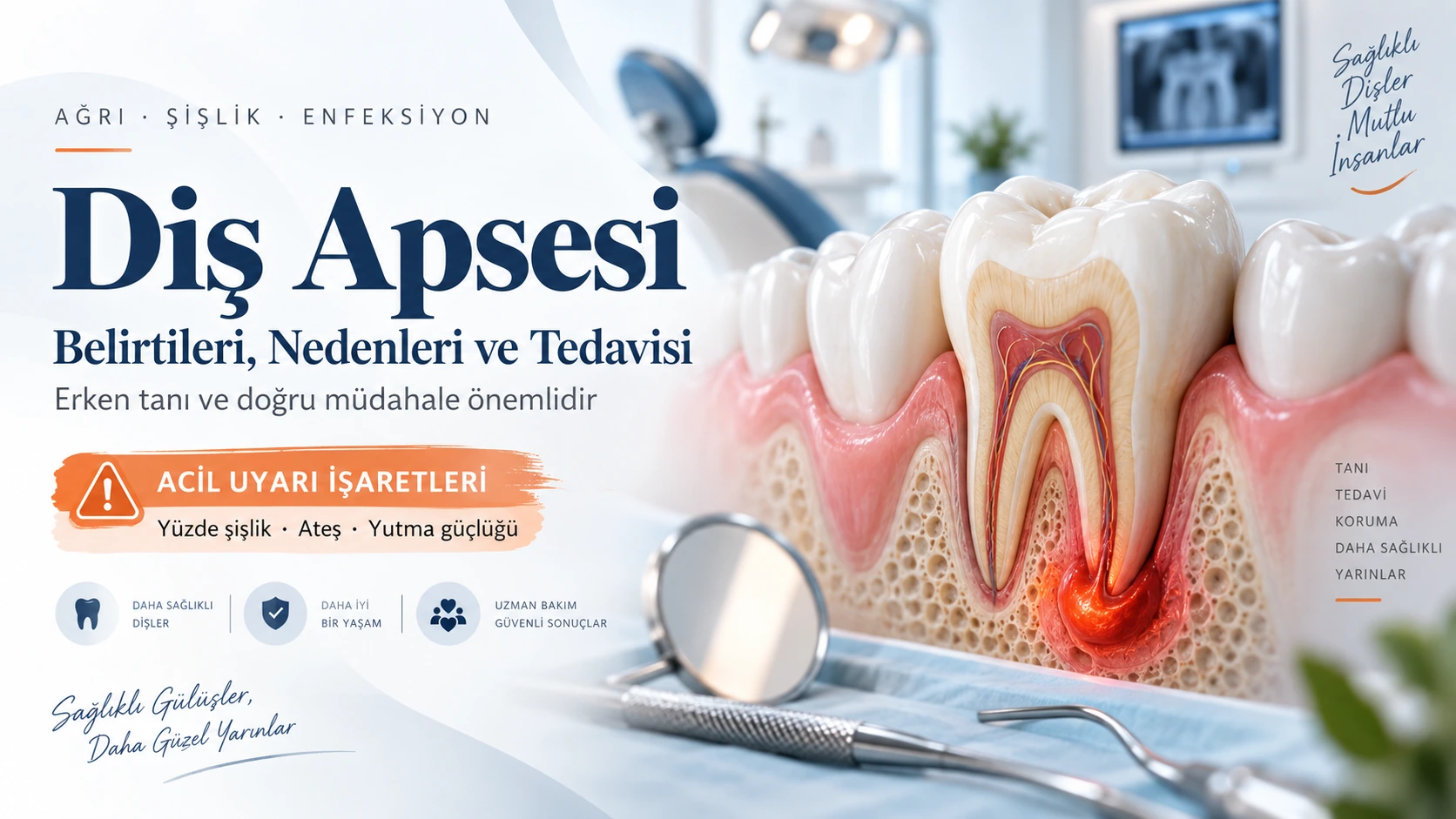 Diş Apsesi: Belirtileri, Nasıl Geçer ve Ne Zaman Acildir?